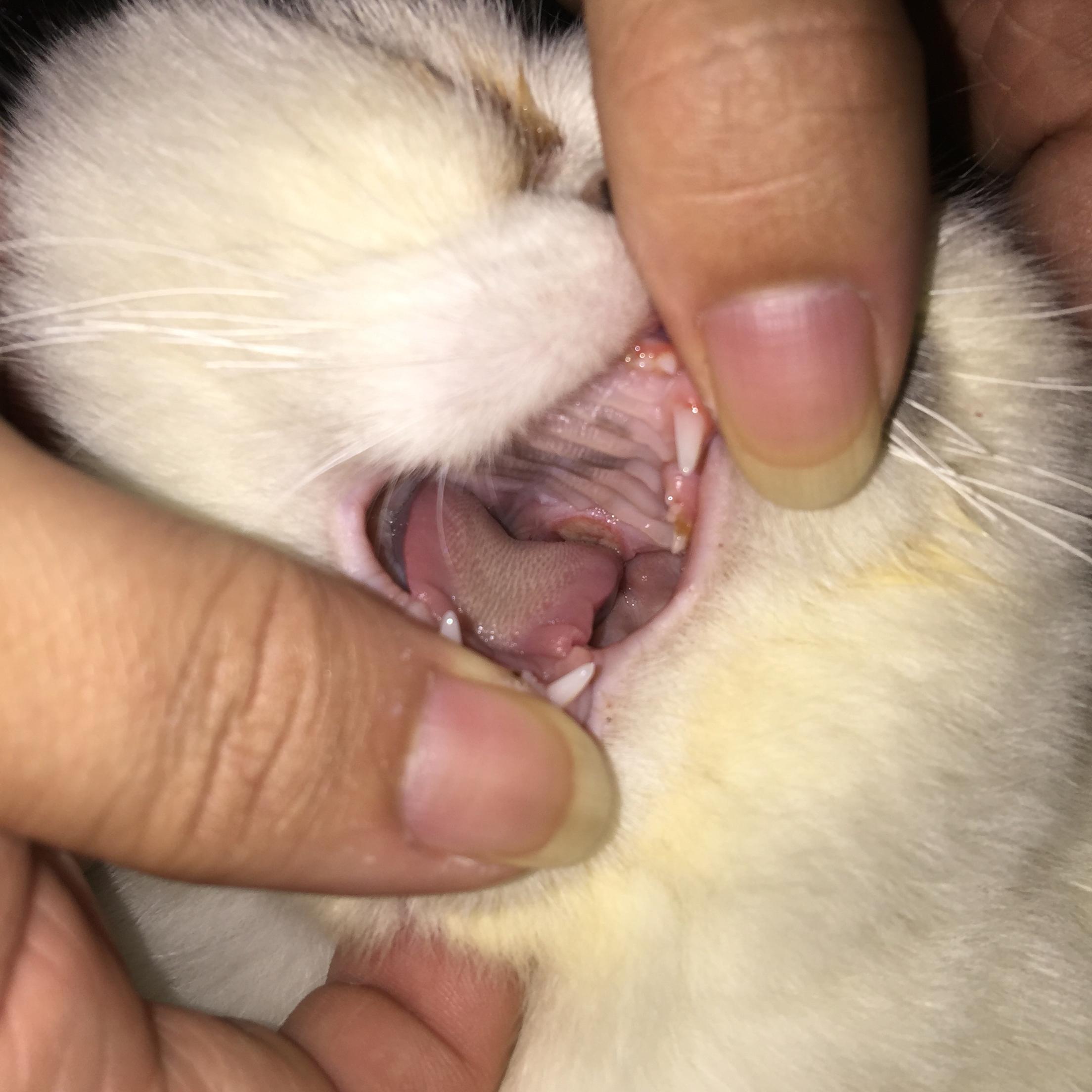 口腔溃疡